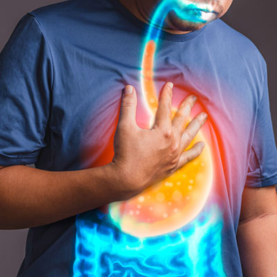 GERD and Acid Reflux